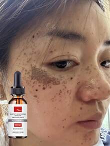 Whitening Hydrating Serum For Facial Skin Lift Tighten Reduce Wrinkles Alcohol-Free Delicate Care Treatment Restore Moisture Brighten Complexion Deep Nourishing Formula With Vitamin C For Even Skin Tone All Skin Types Multiple Specifications - Multicolor - View 1