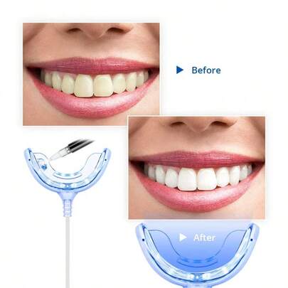 RAF 1 pièce Accélérateur de blanchiment des dents à LED bleue puissante, Booster de blanchiment des dents, incontournable pour la famille, premier choix pour offrir. Gel de blanchiment des dents, blanchiment des dents