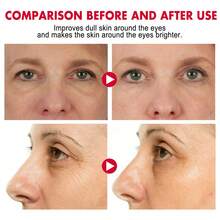 Crema para ojos en barra con retinol Hidrata la piel alrededor de los ojos, mejora la apariencia de líneas finas, patas de gallo y pliegues nasolabiales. - Multicolor - Ver 4