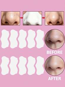 Biore 碧柔深层清洁毛孔贴，白色，10片装，黑头去除贴，快速去除黑头并缩小毛孔，有效减少可见毛孔，蕴含活性炭，深层清洁，吸收油脂，净化肌肤，贴合肌肤轮廓，易于撕除，温和不刺激，是追求光滑肌肤人士的理想之选。 - 白色鼻貼*10 - 查看 3