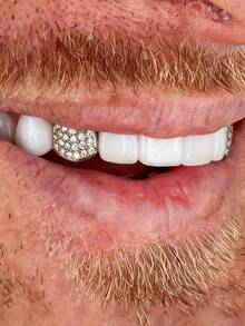 2pcs Hip Hop Style Men's Glitter Tooth Grillz, Popular Accessory For Men At Parties And Music Festivals - Single Braces - View 1