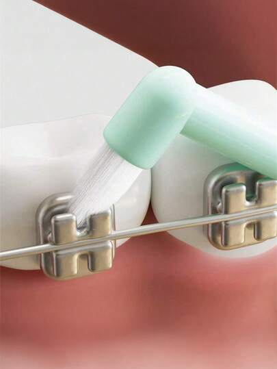 随机 1 件正畸牙间刷，单捆软牙刷，口腔护理工具，牙间牙齿清洁，适合矫正牙齿和戴牙套的人（随机颜色）