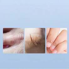 50/100pcs Breathable High-Viscosity Dry Crack Adhesive Tape, Pressure-Sensitive Tape For Cracked Hands And Feet, And Cracked Heels. Independent Packaging - Multicolor - View 6