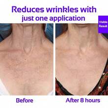 2 片装颈纹贴胸垫，抗硅胶贴片，可重复使用，医用级，夜间护理，适合侧睡者 - 彩色 - 查看 10