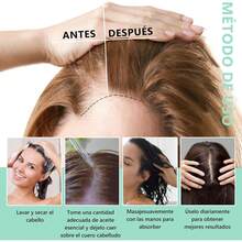 ¡RecomendadoAceite de Romero:Aceite de Romero para El Cabello-Aceite de Romero con Cepillos Masajeador del Cuero Cabelludo Para el Cabello Reparar El Cabello Seco y DañAdo Crecimiento Del-2PCS 60ML Rosemary Oil Hair Growth-100% Puro Natural Cejas Pestañas¡Top de Temporada - 1 - Ver 3