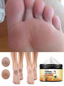 Professional Whitening Foot Scrub Cream Intensive Moisturizer Callus Eliminator Dead Skin Exfoliation Prevents Dryness Cracking Promotes Soft Smooth Feet Enriched With Shea Butter Vitamin E Unscented Foot Care For Dry Cracked Heels - Nhiều màu - Xem 3