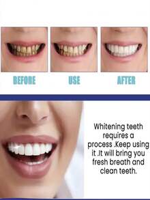 深层美白+清新感受！牙齿美白粉，重拾亮白自信 - 彩色 - 查看 7