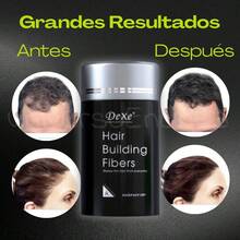 2 Paquetes de Fibras Naturales Capilares de 44g - MX | Disimulan Calvicie, Adherentes y Añaden Volumen a Todo Tipo de Cabello - Negro Estándar - Negro - Ver 9