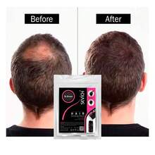 Pack de 100g de Micro Fibras Naturales Adherentes Capilares ÍNEA - Disimula Calvicie en Todo Tipo de Cabello - Café Medio con Frasco Aplicador - Cafe Medio - Ver 4