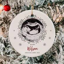 Decorações personalizadas para ultrassom, decorações para anúncio de nascimento, decorações para revelação de gravidez, lembranças de nascimento de bebê e decorações com imagens de ultrassom