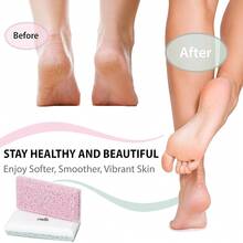 Siliglass Pumice Stone Callus Remover For Feet, Elbows, Hands, And Knees, Spain Made - 2 In 1 Pedicure Exfoliator And Scrubber For Rough, Hard Skin (1 Pack){"Style":"Pink-1Count"} - Pink-1Count - View 5