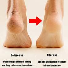 Electric Callus Remover, Professional Electric Callus Remover, Rechargeable Portable Electric Foot File, Electric Callus Remover Kit - Ideal Gift For Smooth, Soft Feet - Hard, Cracked And Dry Skin Care