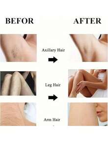 Unisex Crystal Painless Hair Removal Device, Reusable Nano Glass Leg Hair Remover For Women, Magical Crystal Hair Removal Tool For Back, Arms, Legs - No Need To Shave, Washable