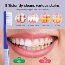 10pcs Adult Medium Toothbrushes. Whitening Toothbrush With Spiral Medium Bristles, Suitable For Stains From Smoking, Tea And Coffee. Deep Plaque Removal. Rounded Bristle Tips, Suitable For Gentle Cleaning - Xanh đậm - Xem 8
