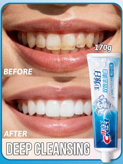 CREST Crest 3D Whitening Toothpaste, Teeth Whitening,Stain Removal,170g, Triple Purification Technology,Discoloration Removal, Bad Breath Removal, Tartar Reduction, Long-Lasting Fresh Breath, Added Pearl Powder, Mint Fresh,Suitable For Teeth Whitening Seekers, Daily Oral Care, Before Important Events,After Meals Cleaning.