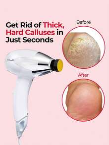 OLASALON Electric Foot Callus Remover, Waterproof Foot Care Tool Set For Removing Calluses, Automatic Robotic Foot Dead Skin Remover, Hard Skin Trimmer, Pedicure Care (Includes 12 Replacement Grinding Heads) - EU C Type Plug(220-240V) - View 3