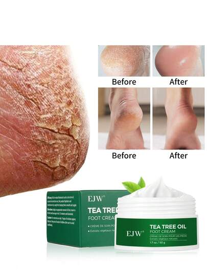 Tea Tree Oil Foot Cream - Intensive Repair For Dry, Cracked Heels & Feet - Instantly Boosts Moisture, Softens Rough Skin - Moisturizing Cream For Foot