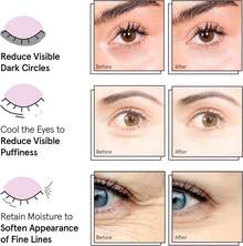 6 Lightening And Brightening Eye Masks To Reduce Dark Circles, Eye Puffiness, Eye Bags, Wrinkles, Gel Eye Masks, Nurse's Gift, Vegetarian And Cruelty-Free Self-Care - Vàng - Xem 8