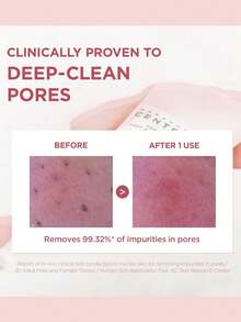 SKIN1004 Madagascar Centella, Poremizing Deep Cleansing Foam,4.22 Fl.Oz, | With Himalayan Pink Salt | Deeply Cleanses Pores, Gently Exfoliates | Prevents Blackheads, Controls Oil