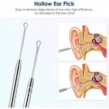 Ear Cleaning Kit, Ear Wax Removal Tool,Earwax Removal Kit,Easy To Use,Painless Ear Pick,With Storage Box And Cleaning Brush (Silver) - Silver - View 3