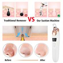 Portable Electric Blackhead Vacuum Remover Kit, Removes Blackheads & Whiteheads, Facial & Skin Care Device, 400mAh - White - View 7