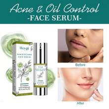 New Arrival-Hoygi Tea Tree Oil Serum Moisturizing Whitening Firming Skin Pore Hydrating Rejuvenating Repair Essence - 1 - Xem 1