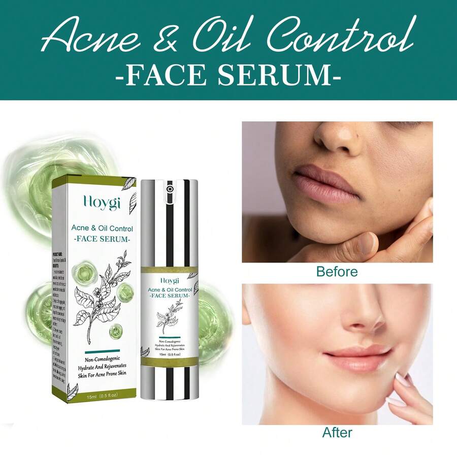 New Arrival-Hoygi Tea Tree Oil Serum Moisturizing Whitening Firming Skin Pore Hydrating Rejuvenating Repair Essence - 1 - Xem 1