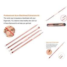 Kit de Aguja de Acero Inoxidable Rosa Metálico para Eliminar Espinillas y Blemishes - 4 Piezas para Cuidado Facial de Mujeres y Hombres - Rosa Metálico - Ver 2