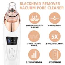 Portable Electric Blackhead Vacuum Remover Kit, Removes Blackheads & Whiteheads, Facial & Skin Care Device, 400mAh - White - View 5