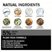 Feet Care Essence Nail Fungal Treatment Feet Care Repair Moisturizing Nail Anti Care Obat Kuku Yang Rusak