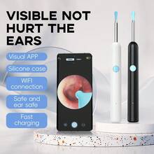 This Smart, Ultra-High-Definition, Wireless Ear Cleaning Tool With A Built-In Light And Display Is A Visual Ear Pick With Ultra-High Definition Ear Endoscope And Replacement Ear Tip Accessories. It's A Painless Ear Cleaning Kit, A Rechargeable Personal Care Product That Easily And Efficiently Removes Earwax. Suitable For Adults. A Thanksgiving And Christmas Promotional Item, Compatible With Apple And Android Phones. - White (standard) - View 6