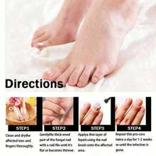 Feet Care Essence Nail Fungal Treatment Feet Care Repair Moisturizing Nail Anti Care Obat Kuku Yang Rusak