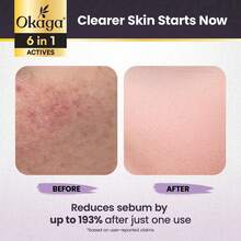 黑米亮肤安瓶 - 升级版亮肤保湿精华，适用于面部和身体，适合所有肤质的去角质精华 - 彩色 - 查看 5