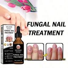 Feet Care Essence Nail Fungal Treatment Feet Care Repair Moisturizing Nail Anti Care Obat Kuku Yang Rusak