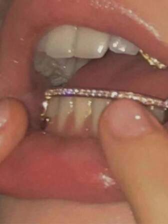 1 pieza Joyería dental Grillz popular de estilo europeo y americano con decoración de colmillos, chapada en metal