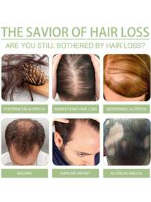 3.38 Oz Rosemary Sesame Hair Oil - Enriched With Coconut Oil And Moroccan Argan Oil. Cleanses Scalp - Massages, Softens And Nourishes Hair - Subtle Coconut Scent - 2-In-1 Shampoo & Conditioner! - Multicolor - View 10