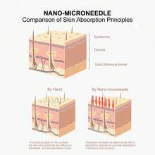 Nuevo medidor de belleza Nano Needleless Hydrafacial Gun nuevo medidor belleza nano needleless hydrafacial gun dispositivo estetica sin agujas tecnologia microdifusion tratamiento facial hidratacion profunda limpieza poros promocion rejuvenecimiento salon spa uso profesional y domicilio guia incluida garantia calidad envio rapido - Dorado - Ver 3