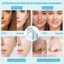 Máquina Facial de Oxígeno de Hidrógeno, 7 En 1 Profesional Diamante Microdermabrasión Máquina Peeling Agua Hydro Dermoabrasión RF Depurador Máquina para Spa, Hogar, Salón . - Verde - Ver 5