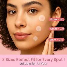 1080pcs Acne Patches With Tea Tree Oil, Gentle & Non-Irritating, Hydrocolloid Material, Covers Body Blemishes, Blackhead Care