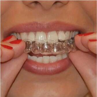 Set de 2 accesorios dentales elegantes y versátiles para blanquear y enderezar los dientes, adecuados para hombres y mujeres, regalo exquisito