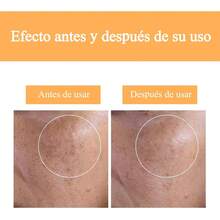 Ácido Glicólico 7% Solución,Hidratante, reafirmante y exfoliante, Ideal para pieles grasas,240ml - 1 - Ver 4