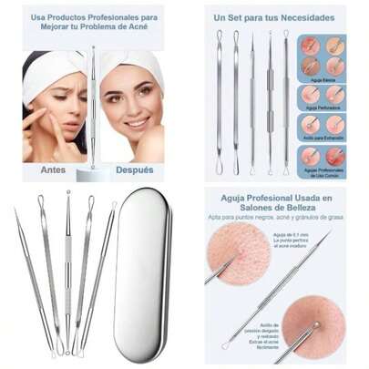 Kit Removedor de Espinillas y Puntos Negros, Extractor de Acn con Estuche Metlico, 5 Herramientas para Eliminar Puntos Negros