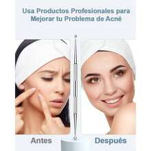 Kit Removedor de Espinillas y Puntos Negros, Extractor de Acn con Estuche Metlico, 5 Herramientas para Eliminar Puntos Negros - plateado - Ver 3