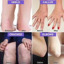 1 pieza Crema con 42% de urea - Reparación intensiva de manos y pies para invierno, apta para piel seca y agrietada - Multicolor - Ver 6