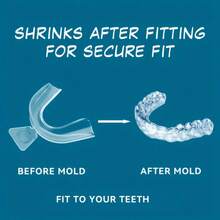 2pcs/Set Exquisite Transparent Teeth Decoration, Suitable For Men And Women, Fashionable Accessory, Wonderful Gift