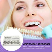 牙科正畸托槽 超薄直丝弓金属托槽 带钩/无钩选项 用于标准正畸治疗 - 彩色 - 查看 2