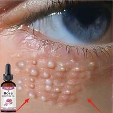 El aceite esencial del ojo tiene un efecto hidratante  Exclusive Love For Delicate Skin! El aceite esencial del ojo tiene un efecto hidratante - Multicolor - Ver 1