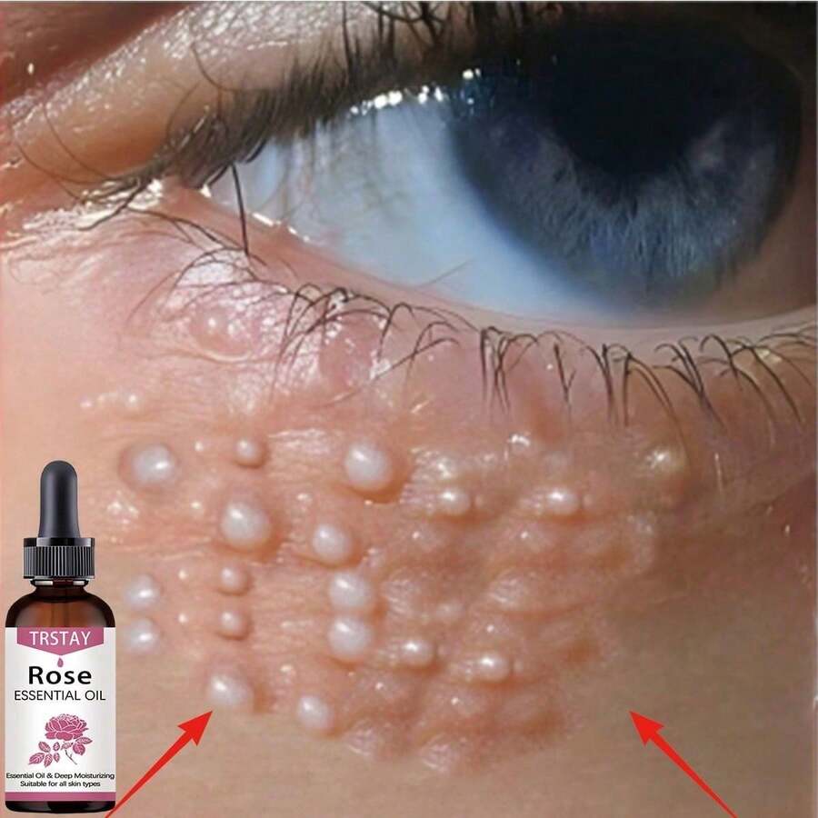 El aceite esencial del ojo tiene un efecto hidratante  Exclusive Love For Delicate Skin! El aceite esencial del ojo tiene un efecto hidratante - Multicolor - Ver 1