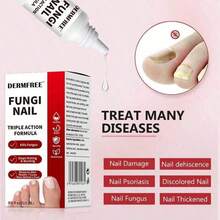 Triple Action Formula For Remove Fungal, Repair And Renewal Damaged Nails, 0.5 Fl Oz,Toenail Fungus Treatment Extra Strength, Antifungal Solution For Toenail Or Fingernail - Default - View 6