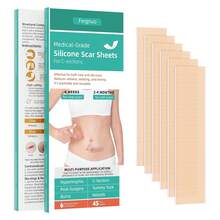 Silicone Scar Tape 6 Sheets - Grade Scar Tape Surgical Scars, Reusable Silicone Scar Sheets C-Section, Surgery, Keloid Scars & Acne Scars - 1.6"X 5.9" - 1 - 查看 8